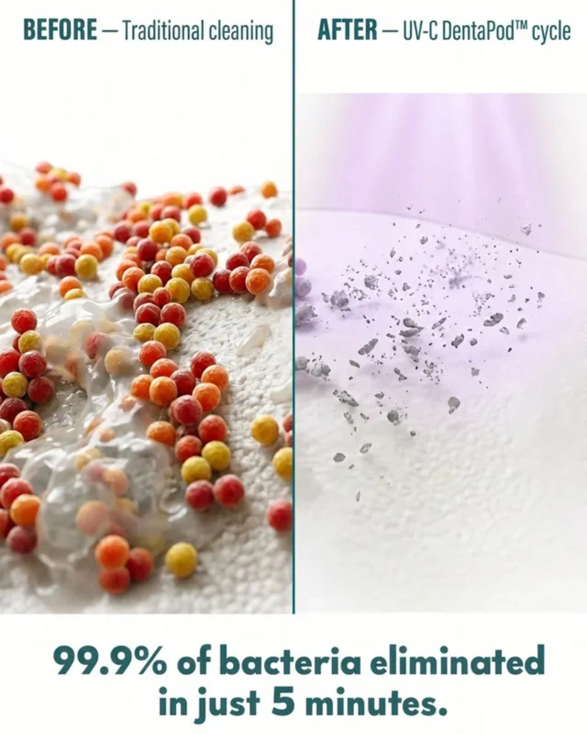 DentaPod™ - Ultrasonic Cleaner & UV Sterilizer